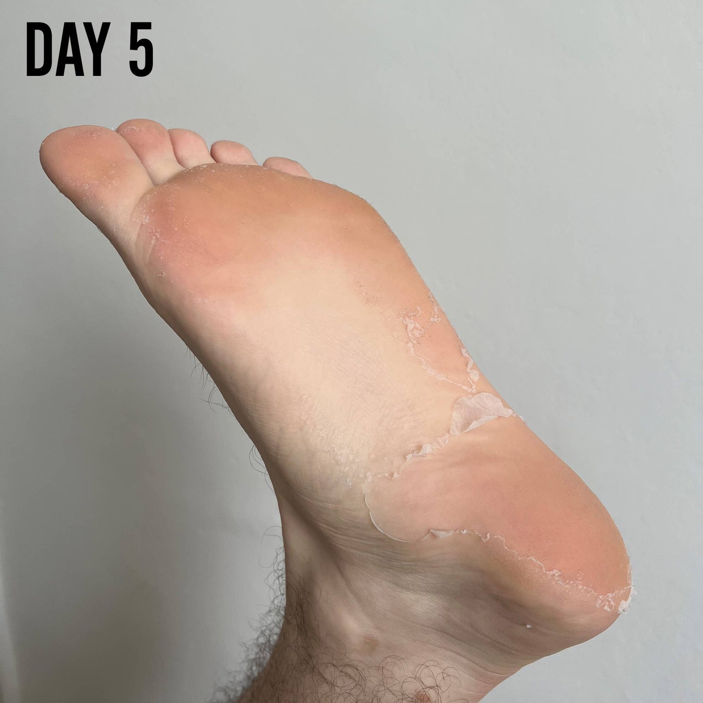 BARBER PRO Foot Peel - Prep the feet for Summer!
