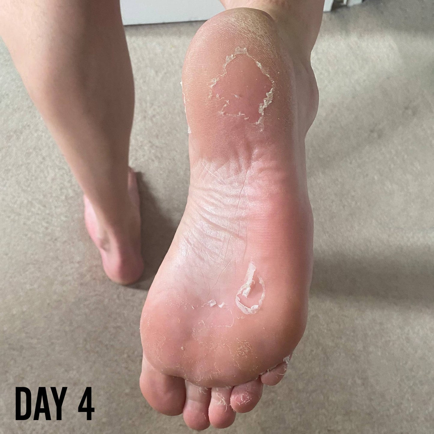 BARBER PRO Foot Peel - Prep the feet for Summer!